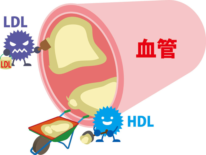 HDL（善玉）コレステロール