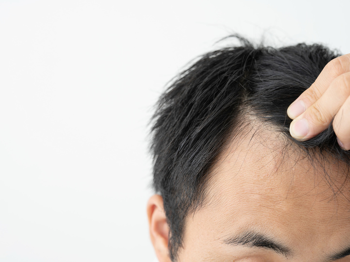 美容師がオススメ 薄毛が目立たない髪型３選 男性編 Yokare